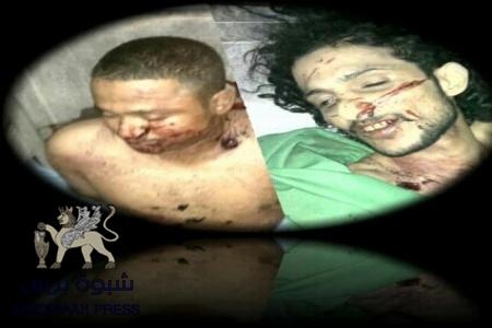 الشيخ الصريمة يتعهد بإقامة مخيم ووجبة غداء لـ 1500 مشارك في يوم الشهداء بشبوة