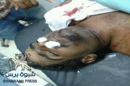 استشهاد إبن شبوة خالد ابوبكر البغدادي برصاص الامن اليمني (ت) الحادية عشرة