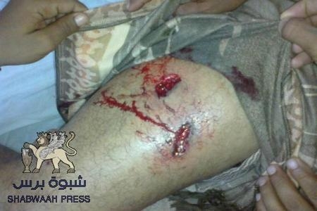 21 فبراير.. يوم الانتقام الرئاسي من شعب الجنوب