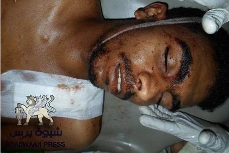 حزب الرابطة بعدن : مجزرة 21 فبراير تؤكد ان السلطة لا تزال تتعامل مع الجنوب وفق فتوى 1994