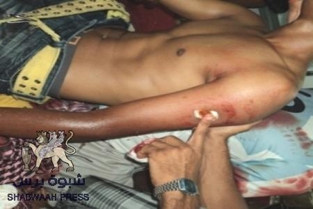 اصابة ثلاثة جنود حضارم في انفجار قنبلة صوتية في مبنى الامن العام بالشحر