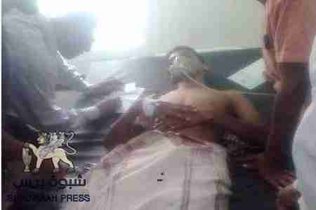 سقوط أربعة جرحى قبل قليل برصاص مستوطن يمني في مدينة القطن وادي حضرموت