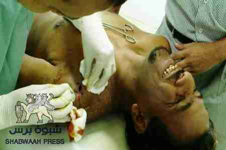 الزميل مهدي الخليفي يخضع لعملية تنظيف جراحه المصاب بها  يوم الكرامة