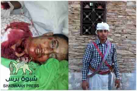 عاجل : قاتل سليمان باعنس يسلم لسجن المكلا تمهيدا لمحاكمته