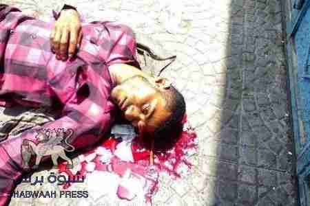 شهيد جديد شاهد على بشاعة الاجرام اليمني في الجنوب .