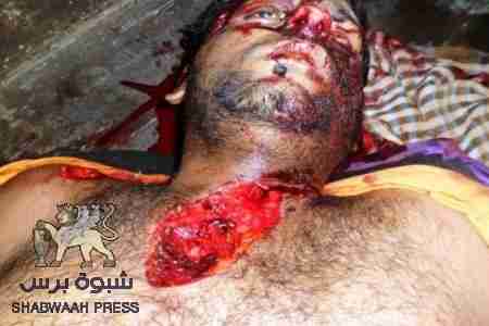 عاجل العثور على شاب مقتول في الضالع بالقرب من معسكر اللواء33