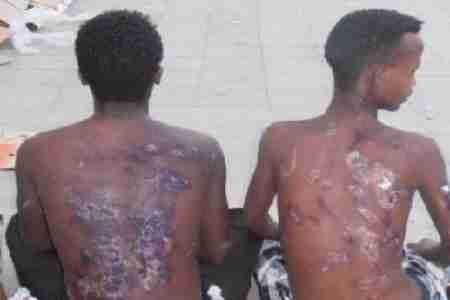 القبض على شبكة تعذيب الأفارقة بالحديدة