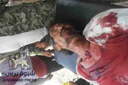 بلاغ صحفي رقم (1) صادر عن الحركة الشبابية بالضالع حول مجريات الأوضاع في الضالع