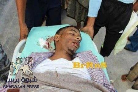المكلا تحت خط النار: أجواء حرب تسيطر على المدينة ورصاص الجنود يصل المستشفيات