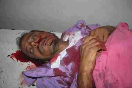 اشتباك مسلح في لحج يؤدي الى مقتل شخصان وجرح آخر