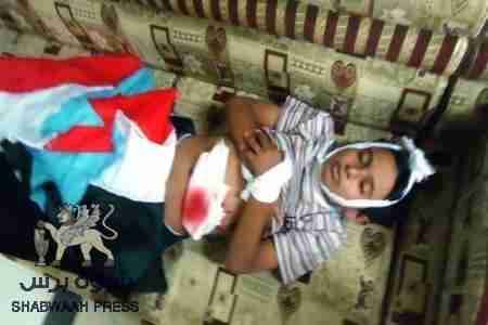 حزب الاصلاح اليمني يسعى لمذبحة جديدة في عدن وشباب شبوة يشترون أكفانهم