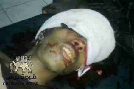 &rlm;أسرة الشهيد درويش تقرر دفنه غدا الجمعة وصلاة الجنازة في ساحة الحرية بالمعلا