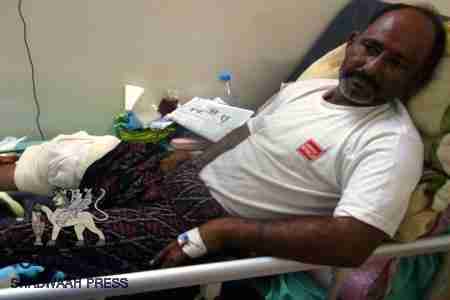 اصابة قيادي في الحراك الجنوبي برصاص طقم عسكري