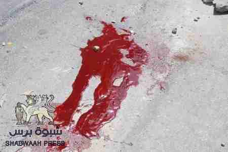 اصابة الشاب محمد بن حازم اصابة خطرة برصاص الجيش في حي الشهيد بالمكلا