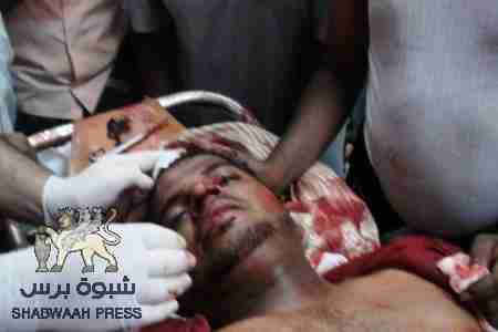 التوتر يسود المكلا بعد مصادمات مع قوات البحرية اليمنية والسبب معاكسة جنود البحرية لامرأة (صور)