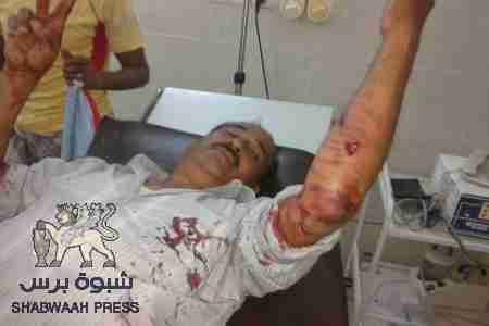 قوات الجيش اليمني تطلق النار على أبناء تريم العائدين من عدن وتصيب عبدالقادر الكاف