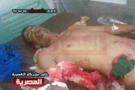 انفجار لغم أرضي في مدينة الشحر ومقتل مواطن وجندي واصابة خمسة جنود بجراح