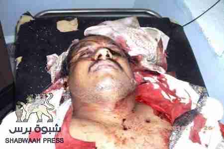 معلومات جديدة عن مقتل الرائد ماجد مطير في القطن صباح اليوم