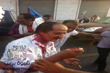 بتر اذن العميد محسن علي عبيد من قبل الأمن اليمني أمام فندق الشيراتون في عدن(صور)