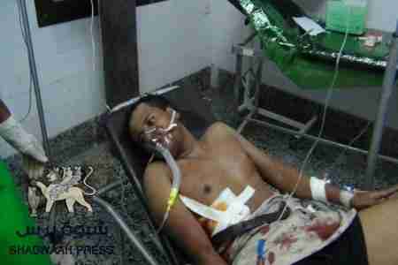 إصابة شابين بشضايا قنبلة ورصاص حي أطلقة عملاء للإحتلال اليمني على شباب الحراك في حوطة شبام