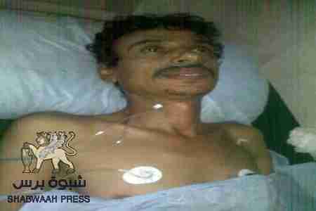 لو كان هذا الضابط شماليا لنقل بطائرة إخلاء طبي الى الرياض أو المانيا