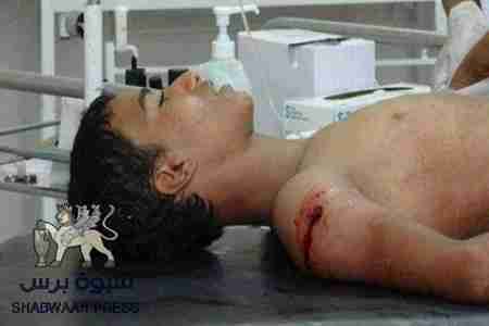 عاجل- استشهاد ناشط في الحراك الجنوبي بحملة عسكرية بالممدارة