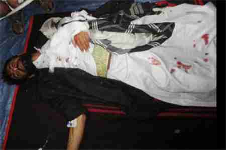 مقتل شخص وإصابة نحو 15 آخرين في تفريق الأمن لتظاهرة أمام مقر الأمن القومي