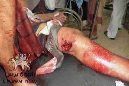 تدهور الحالة الصحية للجريح الأبكم ثابت بن جوهر وأسرته تحمل صندوق الاغاثة مسؤولية ذلك