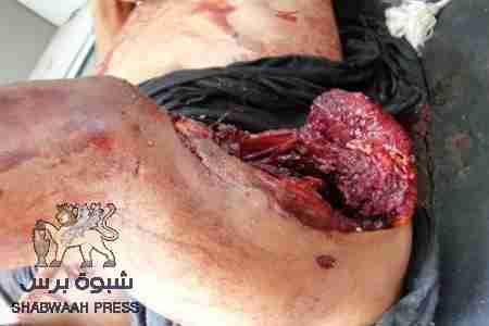 صنعاء تستنفذ جميع اوراقها ازاء الجنوب .. وتعلن الحرب !