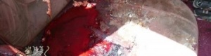 تقرير خاص لـ شبوة برس: عن أول عملية قتل لكادر عسكري جنوبي في شبوة (صورمخيفة)