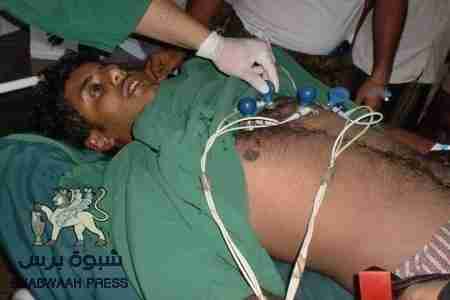 صور وتفاصيل عن الجرحى من أبناء شبوه بمستشفى صابر