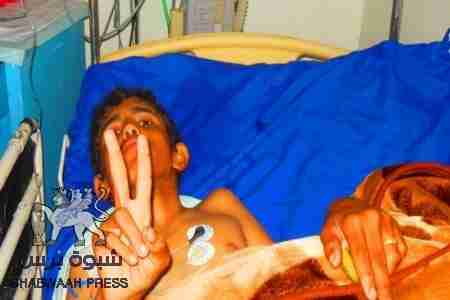 صور جديدة لجرحى شبوه و لسيارة لبهص المضروبة بالرصاص (فيديو)