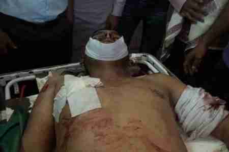 إغتيال الناشط الثقافي في جماعة انصار الله بتعز بسام عبدالغني الجنيد