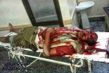 دعوة لإغلاق مكاتب الأمن بكل مديريات الجنوب عامة ردا على سياكل الموت