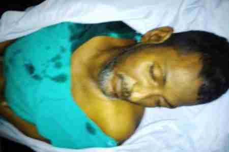 وفاة مواطن من الجنوب العربى فى ظروف غامضة بمصر ومصدر يؤكد تعرضه للسرقة من السفارة اليمنية