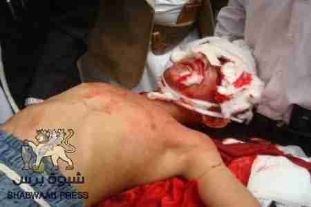 تضارب الأنباء بشأن ضحايا من الأطفال بإنفجار قذيفة في الشيخ عثمان - عدن