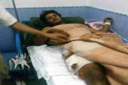 جرحى&lsquo;&lsquo;موكب شبوه&lsquo;&lsquo; في وضع صحي حرج بعد تخلى صندوق إغاثة البيض عنهم وسفر أحدهم الى القاهرة (أرقام)