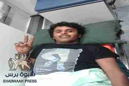 إجراء عملية جراحية ناجحة للجريح الشبواني صدام حسين