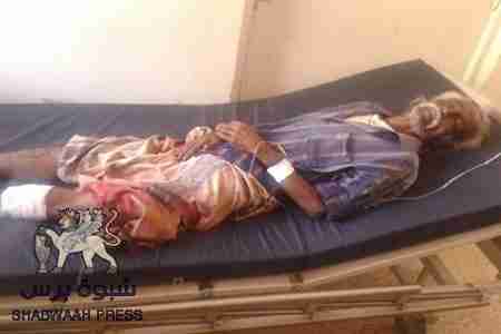 أربعاء دامي في الجنوب : سقوط قتيل وجريح في المكلا وارتفاع جرحى شبوة الى أربعة