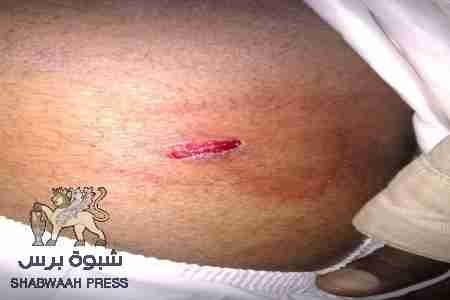 عنصرية صنعاء : جنوبي يشكو مضايقات من السكان وتعسف السلطات الأمنية (ملف صور)