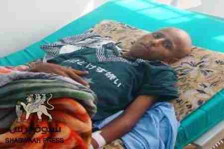 كشف بأسماء عشرات الضحايا صرعى السرطان بالمصينعة بشبوه .. وسلطات صنعاء تتجاهل الكارثة