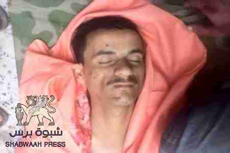 مقتل شاب في الضالع وتوتر شديد يعم المدينه (صور مؤلمة)