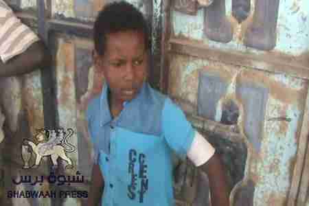 ملاح ردفان : اصابة طفل وانتشار عسكري غير مسبوق (صور)