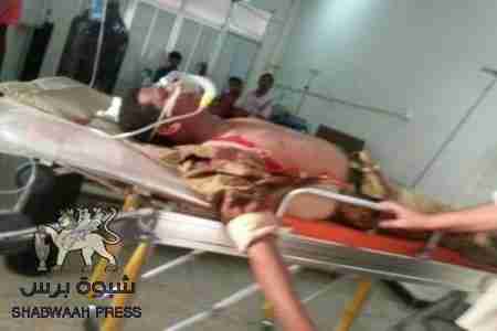 عاجل : &lsquo;&lsquo; شبوه برس &lsquo;&lsquo; ينشر الصور الأولى لقتلى وجرحى معارك الشحر