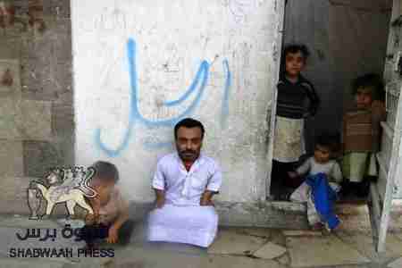 ممثل يمني يخرج عن صمته ويناشد الحكومة بانقاده من وضعة  المتدهور