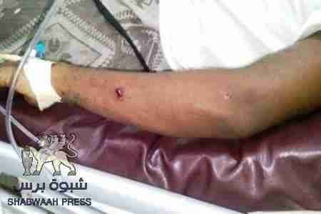 المواطنون في الشحر يلقون القبض على لص والشرطة تكافئهم بإطلاق الرصاص وإصابة شابين