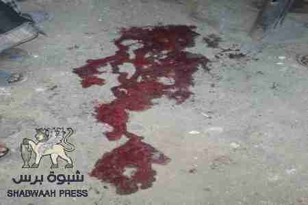 قيادة المؤتمر الشعبي العام بساحل حضرموت تستنكر حادثة اغتيال الشيخ العليي وتطالب بمحاسبة قاتلية