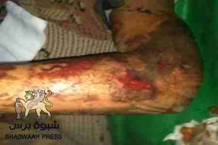 مصرع خمسة حضارم في الطريق الى دماج ومجموع قتلى حضرموت 47 قتيلا