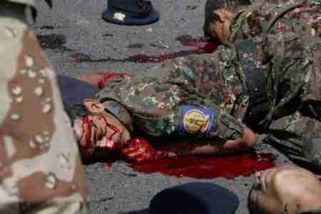 عاد الى الحياة : أحد قتلى هجوم العرضي يعود إلى الحياة