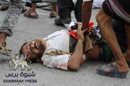 &lsquo;&lsquo;نايف الكلدي&lsquo;&lsquo; جرح الوطن النازف ... ومناضلي فنادق الـ 5 نجوم !!